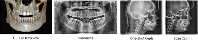 3 in 1 Digital X-ray System ̹