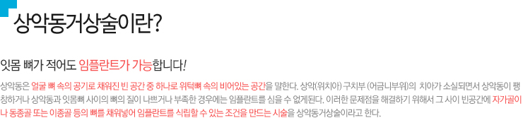 상악동거상술이란? / 잇몸 뼈가 적어도 임플란트가 가능합니다!,  상악동은 얼굴 뼈 속의 공기로 채워진 빈 공간 중 하나로 위턱뼈 속의 비어있는 공간을 말한다. 상악(위치아) 구치부 (어금니부위)의  치아가 소실되면서 상악동이 팽 창하거나 상악동과 잇몸뼈 사이의 뼈의 질이 나쁘거나 부족한 경우에는 임플란트를 심을 수 없게된다. 이러한 문제점을 해결하기 위해서 그 사이 빈공간에 자가골이나 동종골 또는 이종골 등의 뼈를 채워넣어 임플란트를 식립할 수 있는 조건을 만드는 시술을 상악동거상술이라고 한다.
